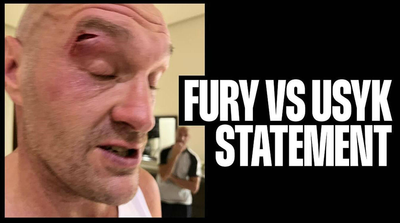 WBC-Tyson-Fury.jpg